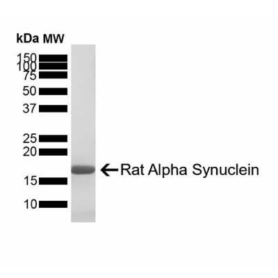 SDS-PAGE: Recombinant Rat alpha-Synuclein Active, Monomer Protein [NBP3-14773]